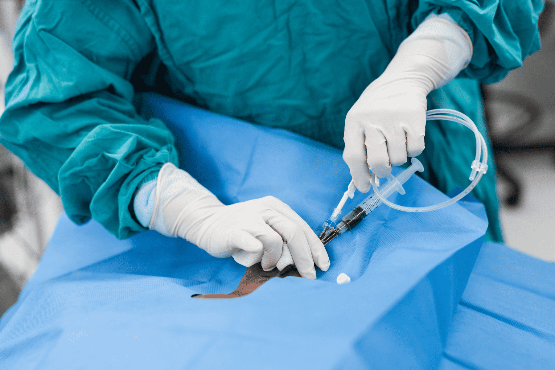 A doctor performing a catheter embolization of malformed veins.